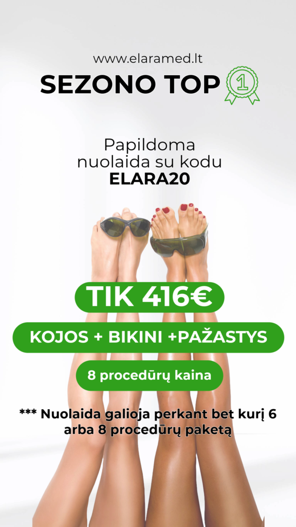 kojos+bikini+ pazastys:price: story