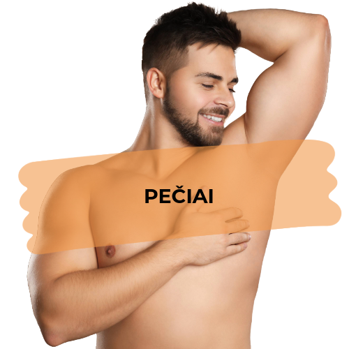 Pečiai - 1 procedūra
